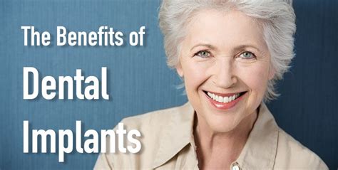 Benefits and Risks of Dental implants