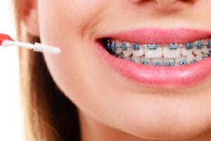 4 Helpful Tips to Survive Your First Week With Dental Braces – Our Guide