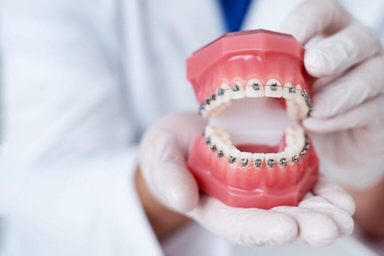 AGGA Dental Device